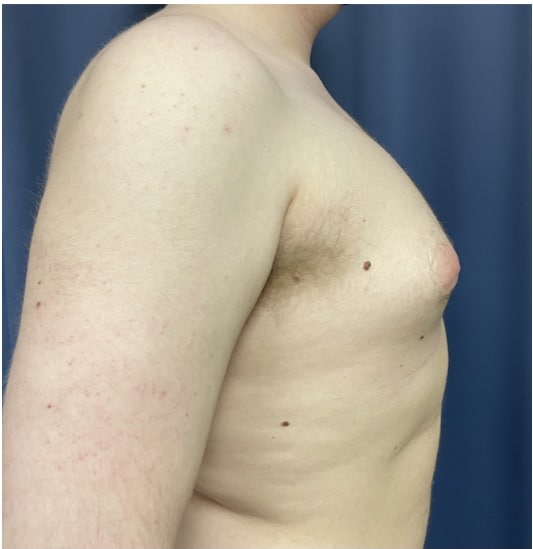 Before Image