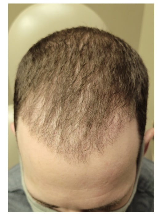 After Image