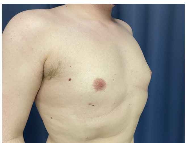 After Image
