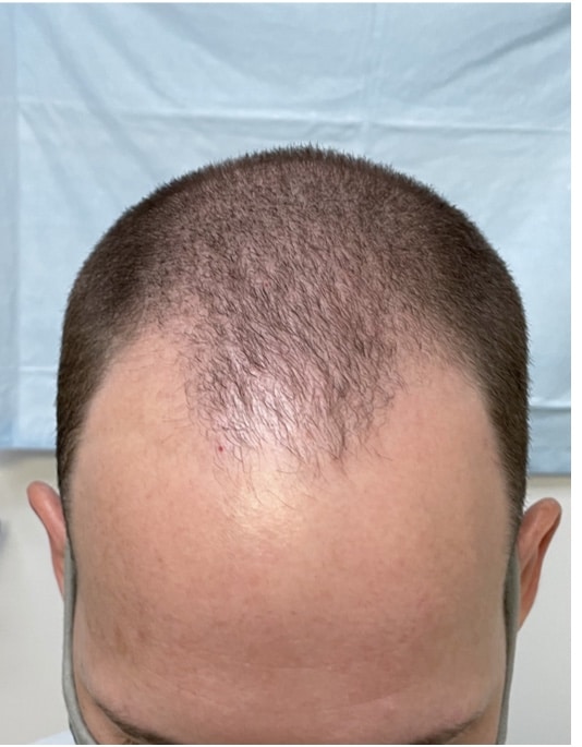 Before Image