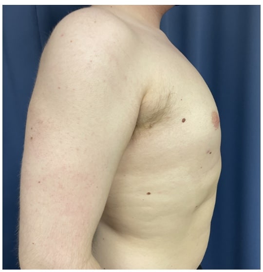 After Image