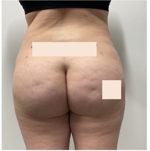 After Image
