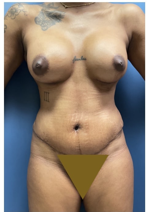 After Image