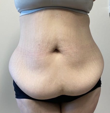 Before Image