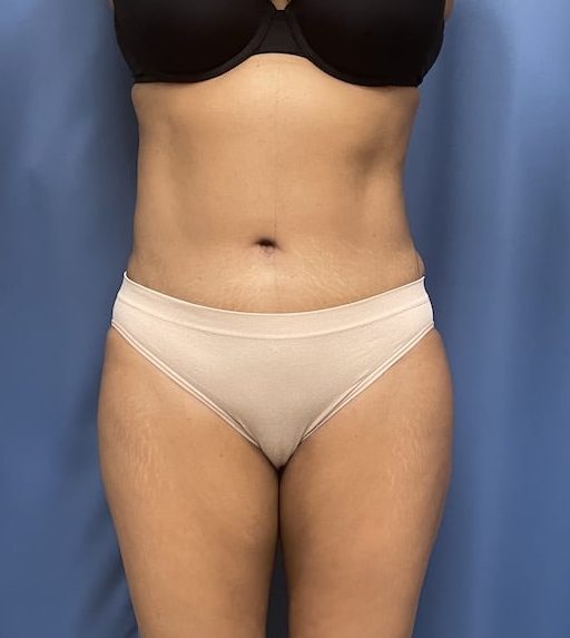 After Image