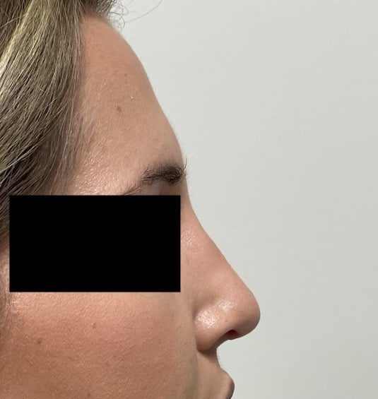 After Image