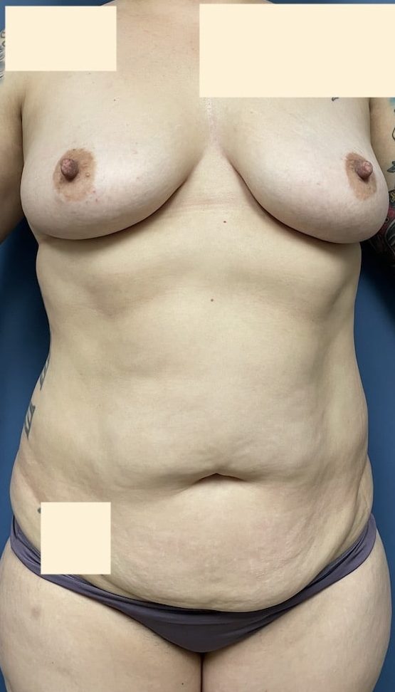 Before Image