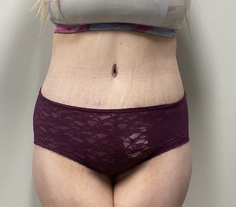 After Image