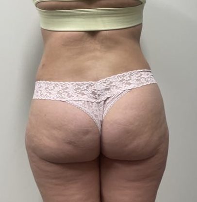 After Image