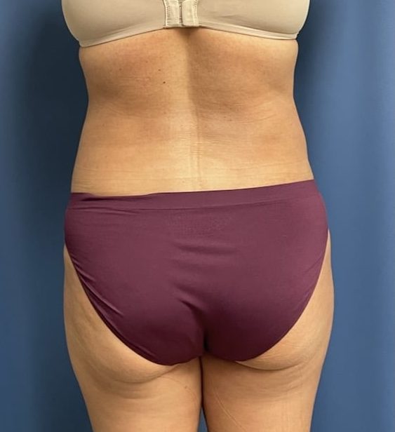 After Image