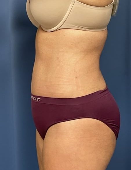 After Image