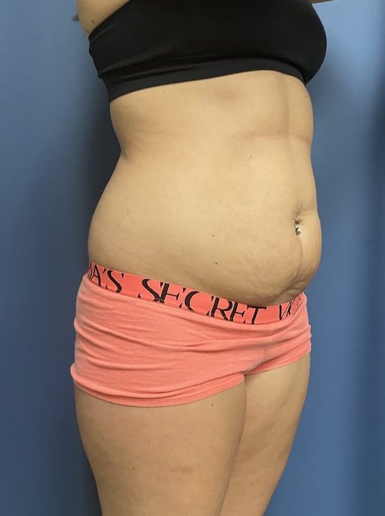Before Image