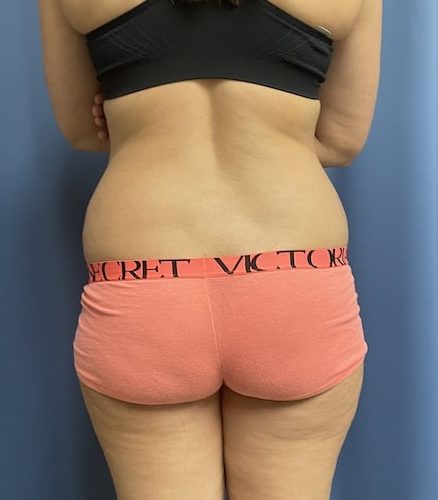 Before Image