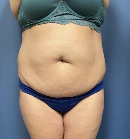 Before Image