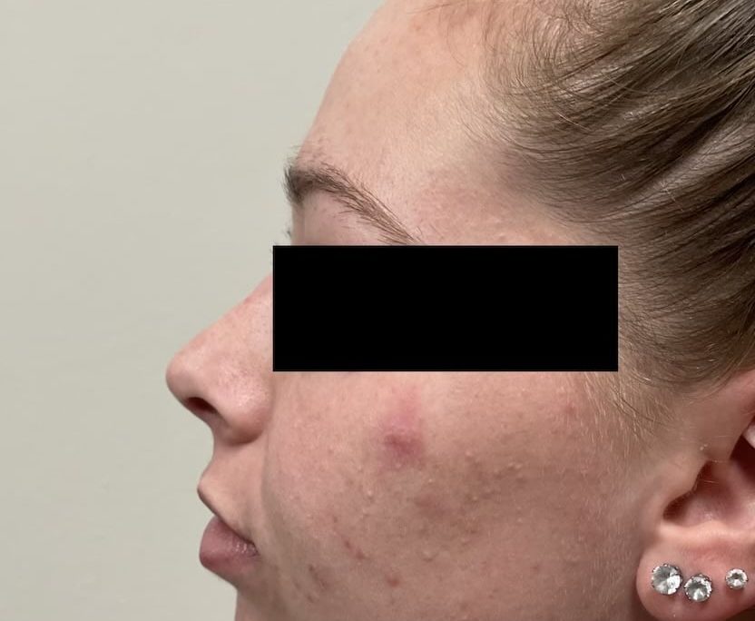 After Image