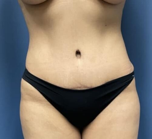 After Image