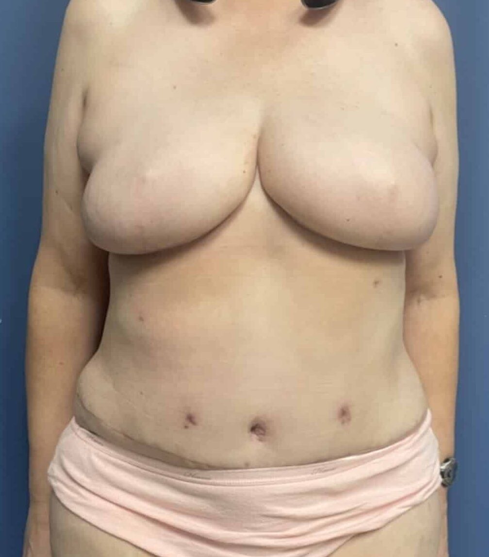 After Image