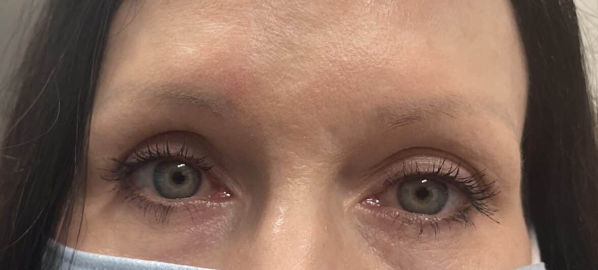 Before Image