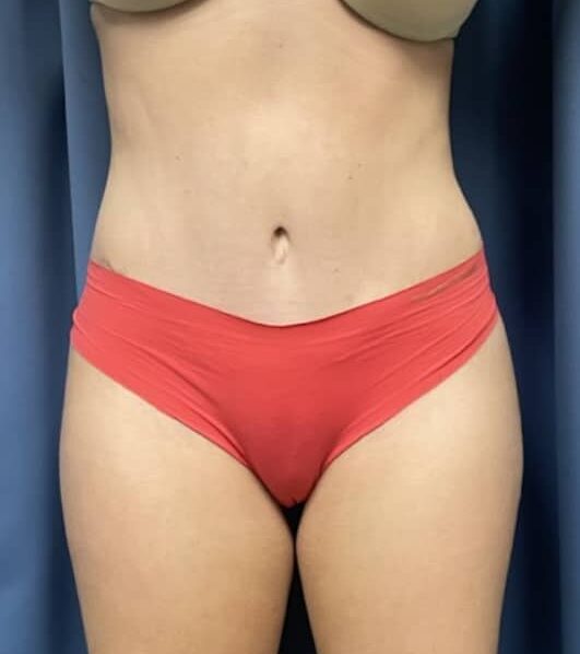 After Image