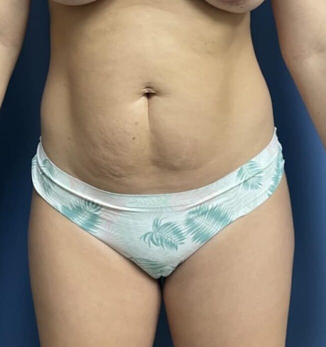 Before Image