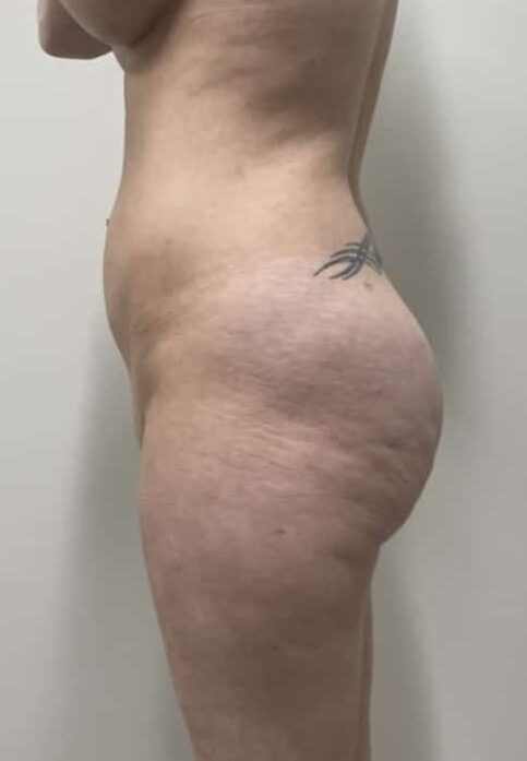 After Image