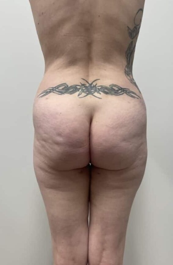 After Image