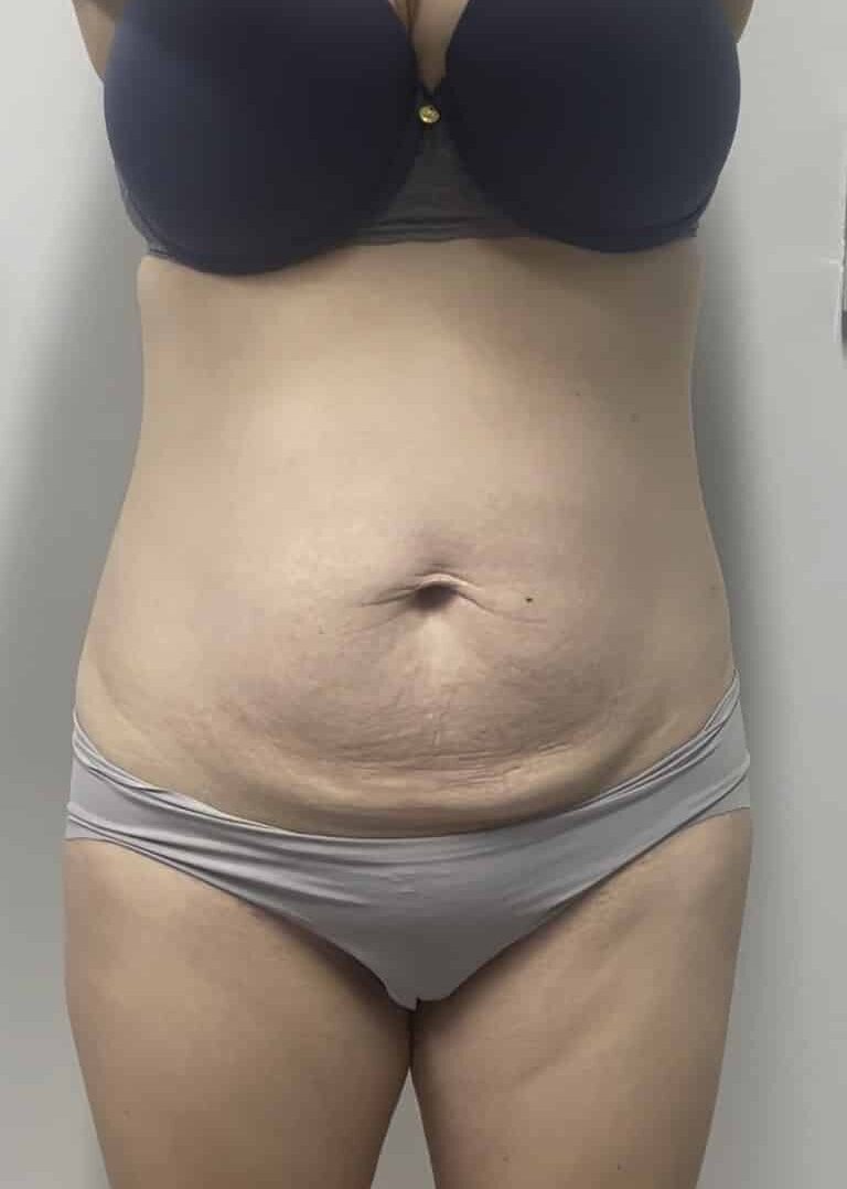 Before Image
