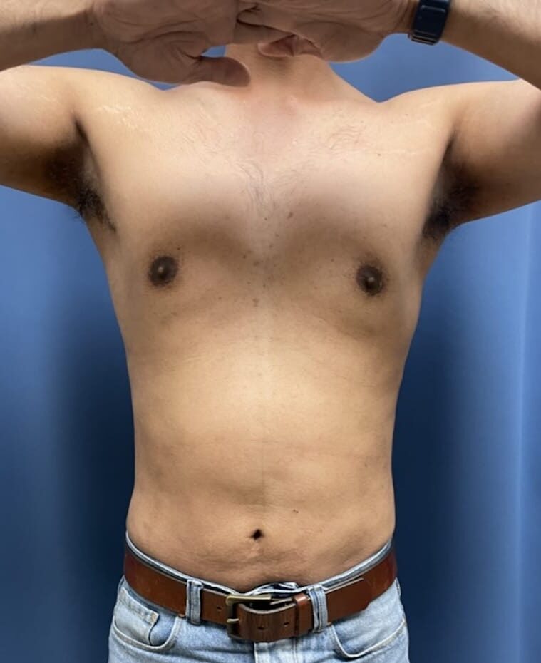 After Image