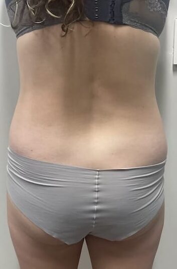 Before Image