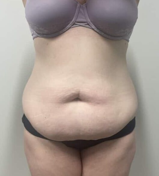Before Image