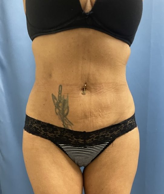 After Image