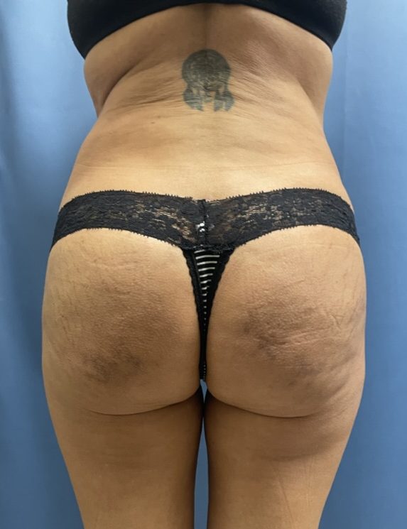 After Image