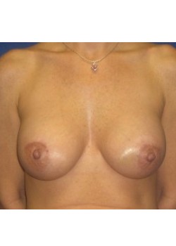 After Image