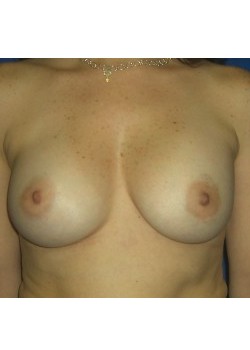 After Image