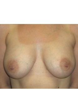 After Image