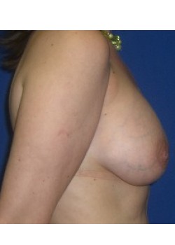 After Image