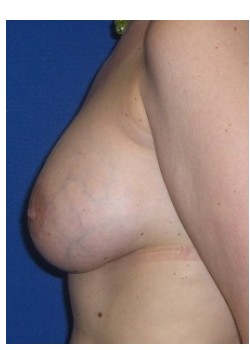 After Image