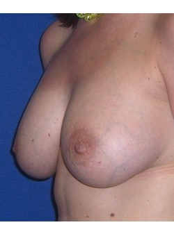 After Image
