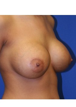 After Image
