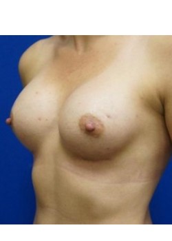 After Image