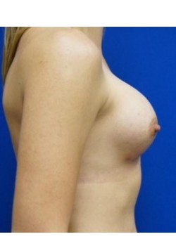 After Image