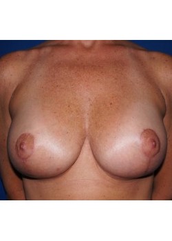 After Image