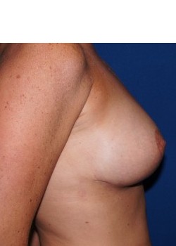 After Image