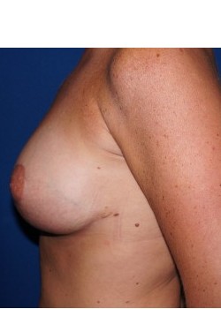 After Image