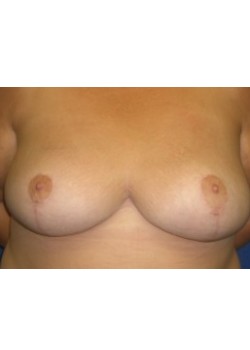 After Image