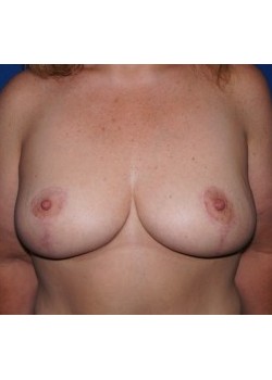 After Image