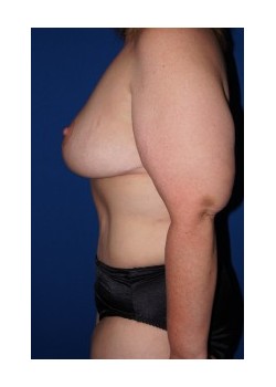 After Image