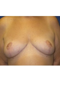 After Image