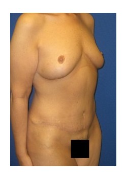 After Image