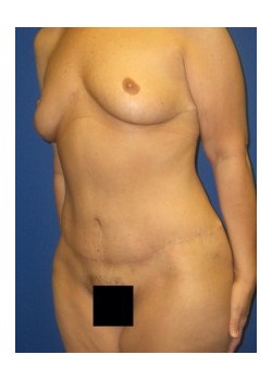 After Image